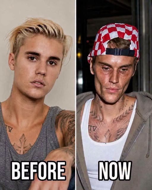 Justin Bieber’s Public Turning Point: From Teenage Stardom to Personal Growth