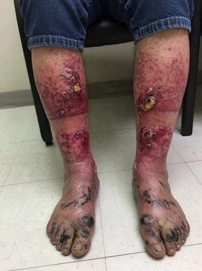 These are the consequences of sleeping with the…